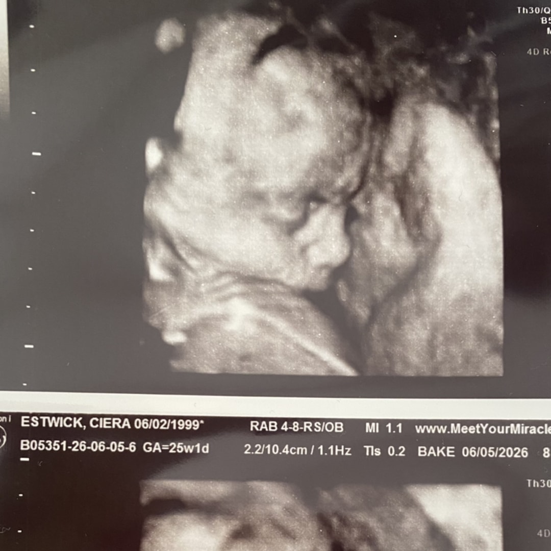 Photo shared by Ciera for their Babylist baby registry.