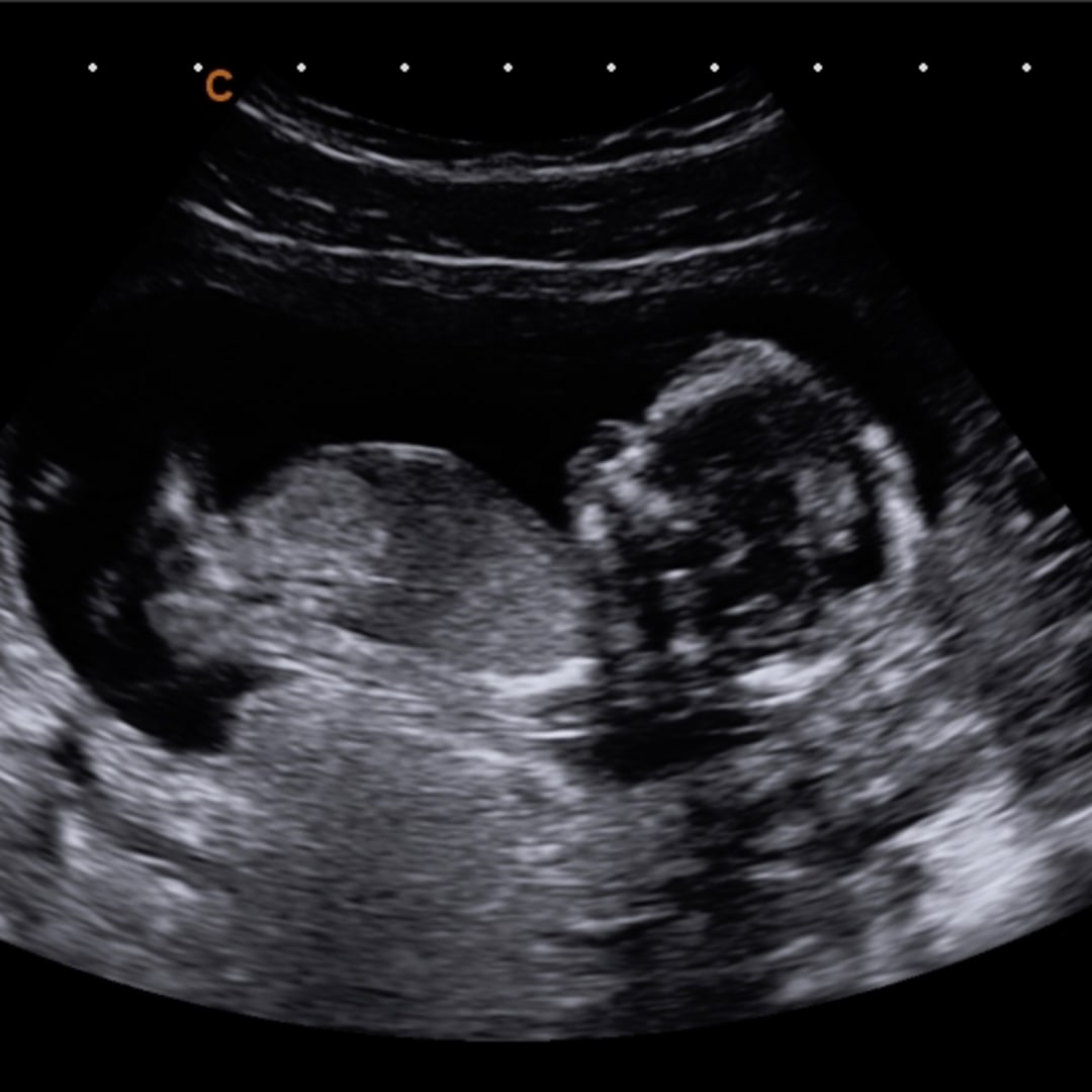 Photo shared by Trinity for their Babylist baby registry.