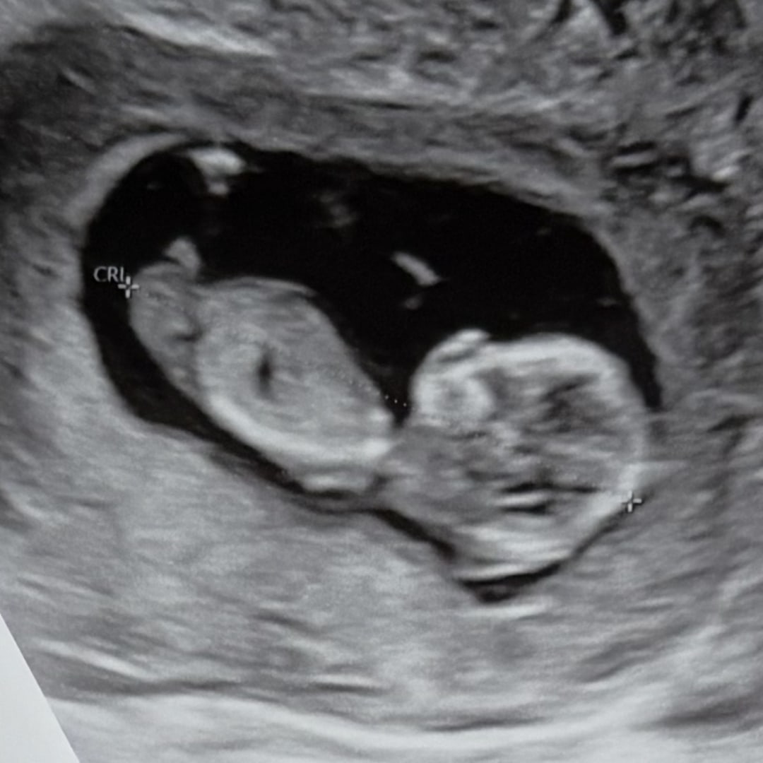 Photo shared by Isabella for their Babylist baby registry.