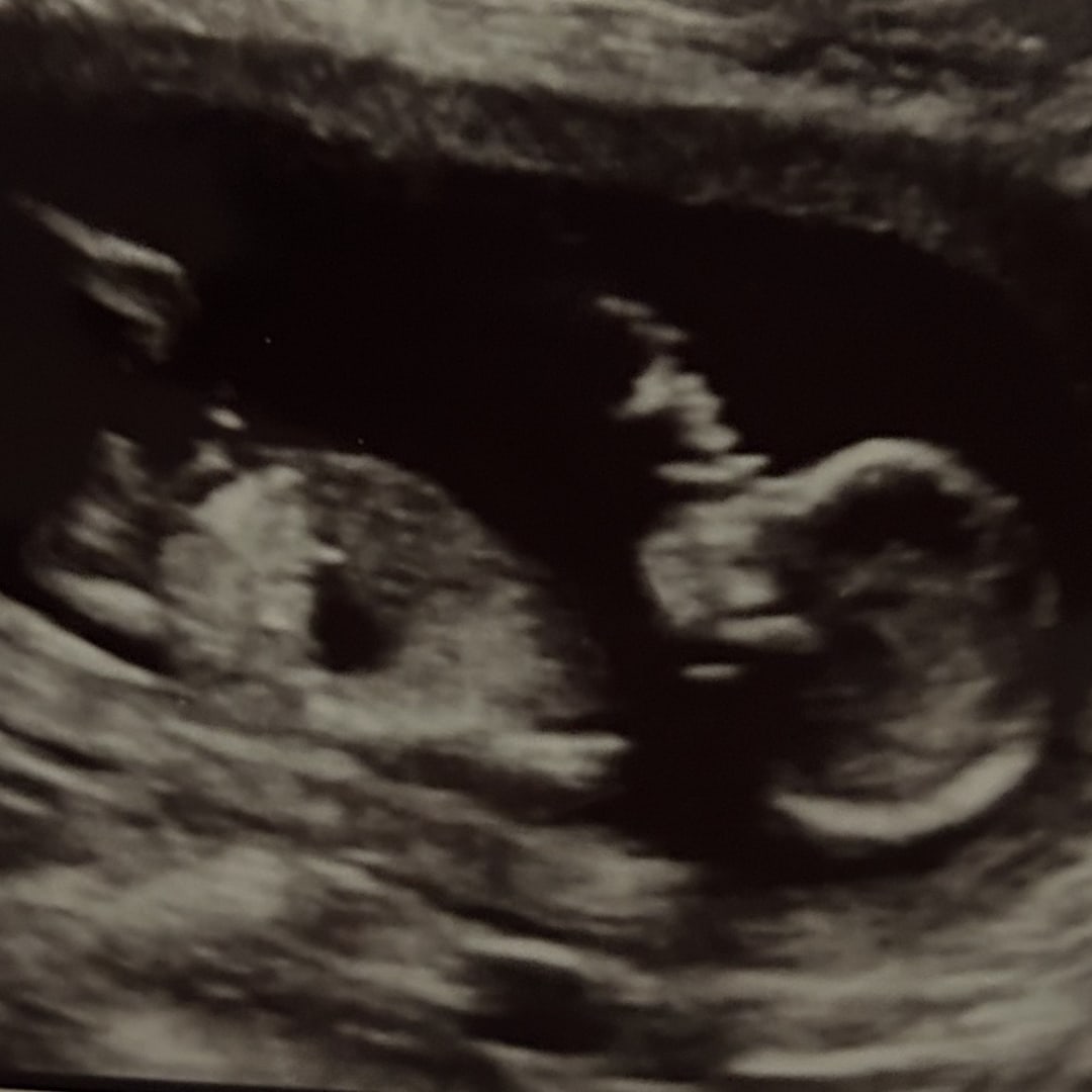 Photo shared by Lorraine for their Babylist baby registry.