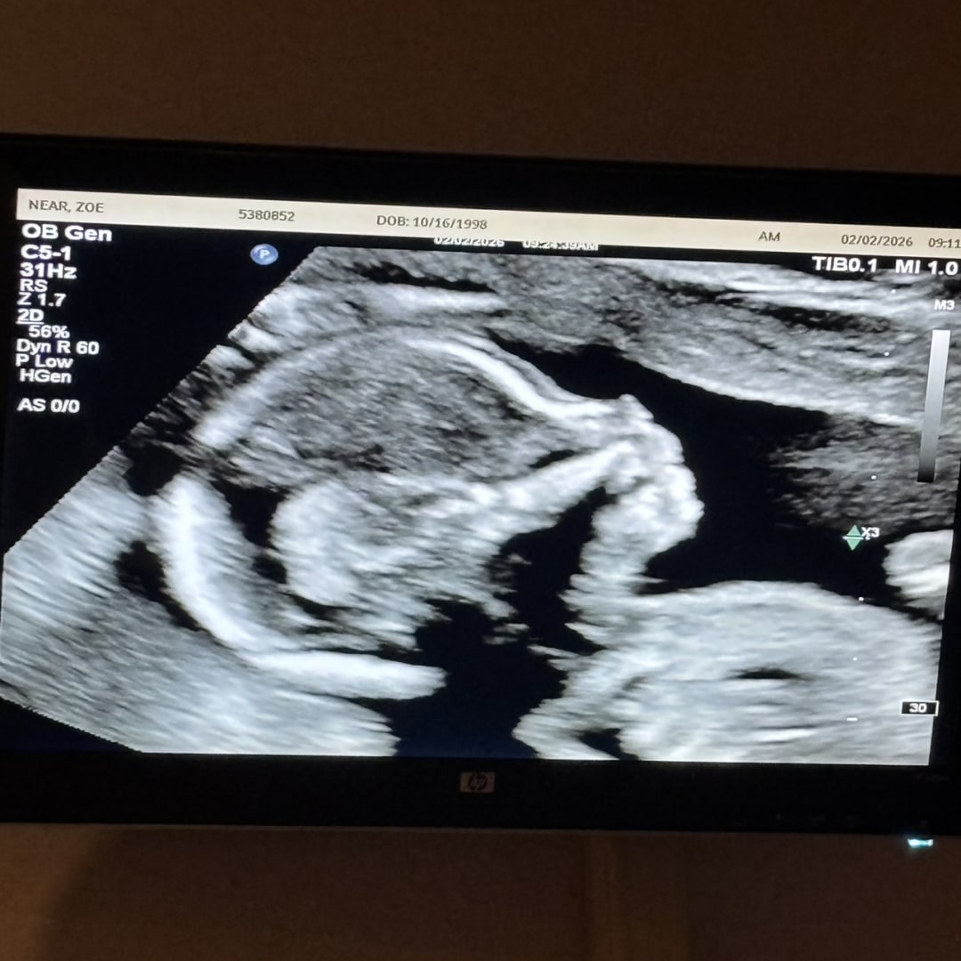 Photo shared by Zoe for their Babylist baby registry.