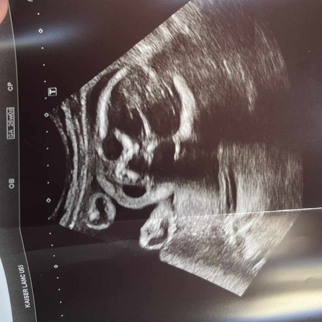 Photo shared by Olive for their Babylist baby registry.