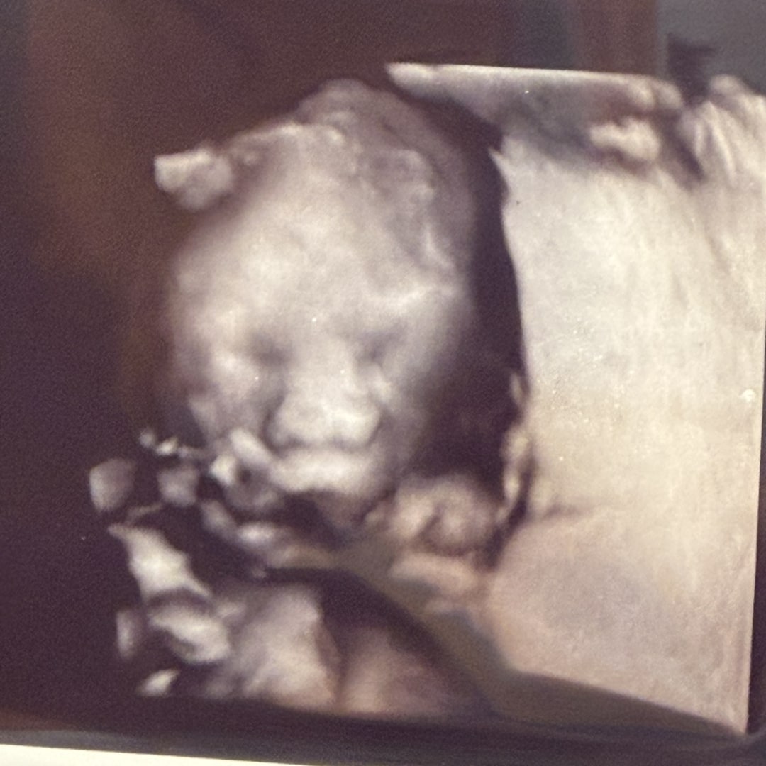 Photo shared by Hannah for their Babylist baby registry.