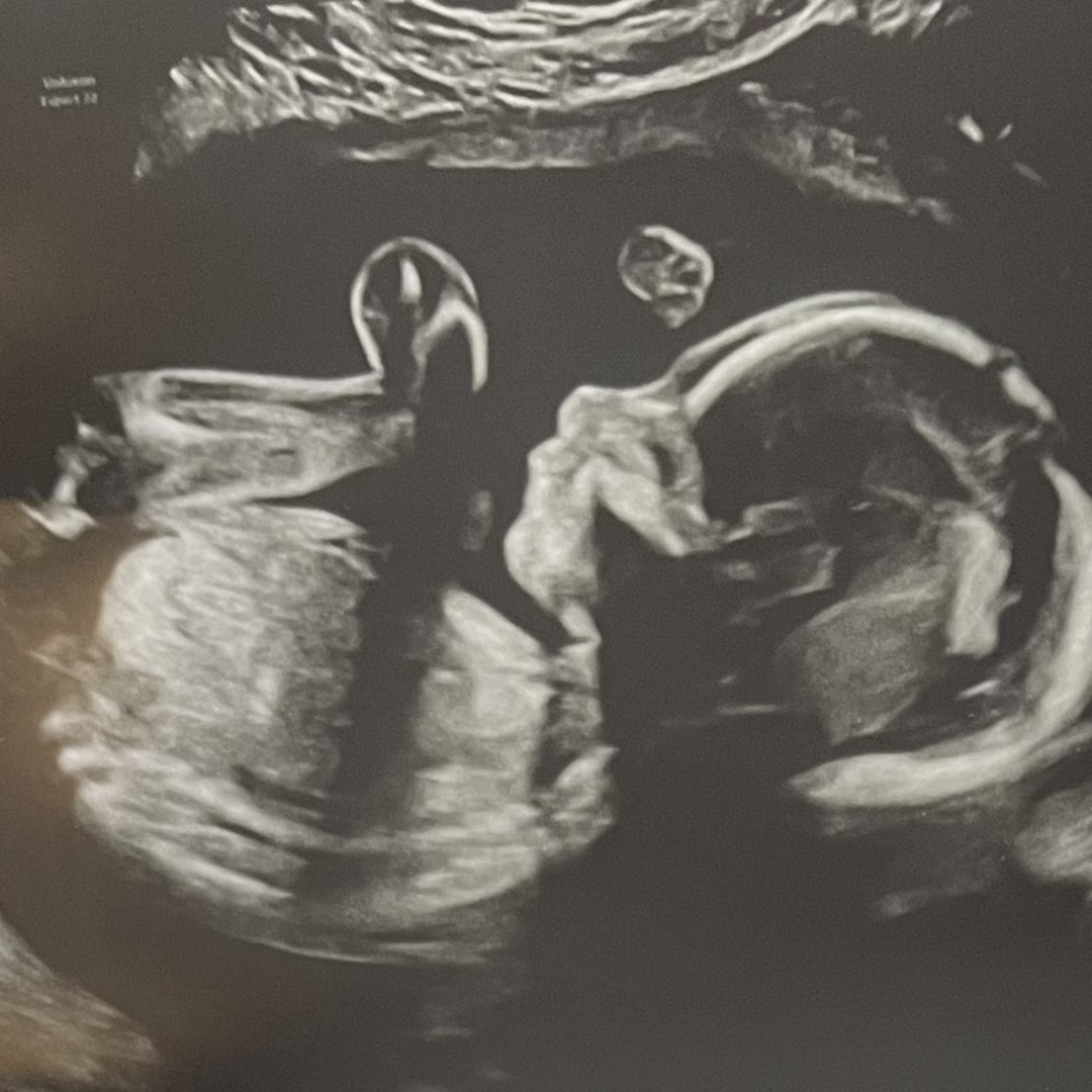 Photo shared by Abbey for their Babylist baby registry.