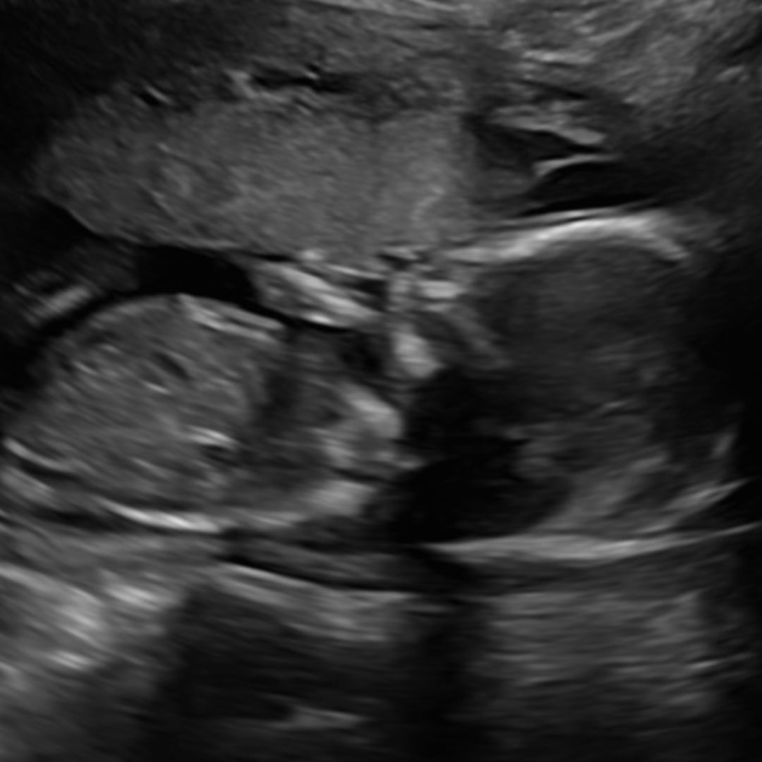 Photo shared by Cynthea for their Babylist baby registry.