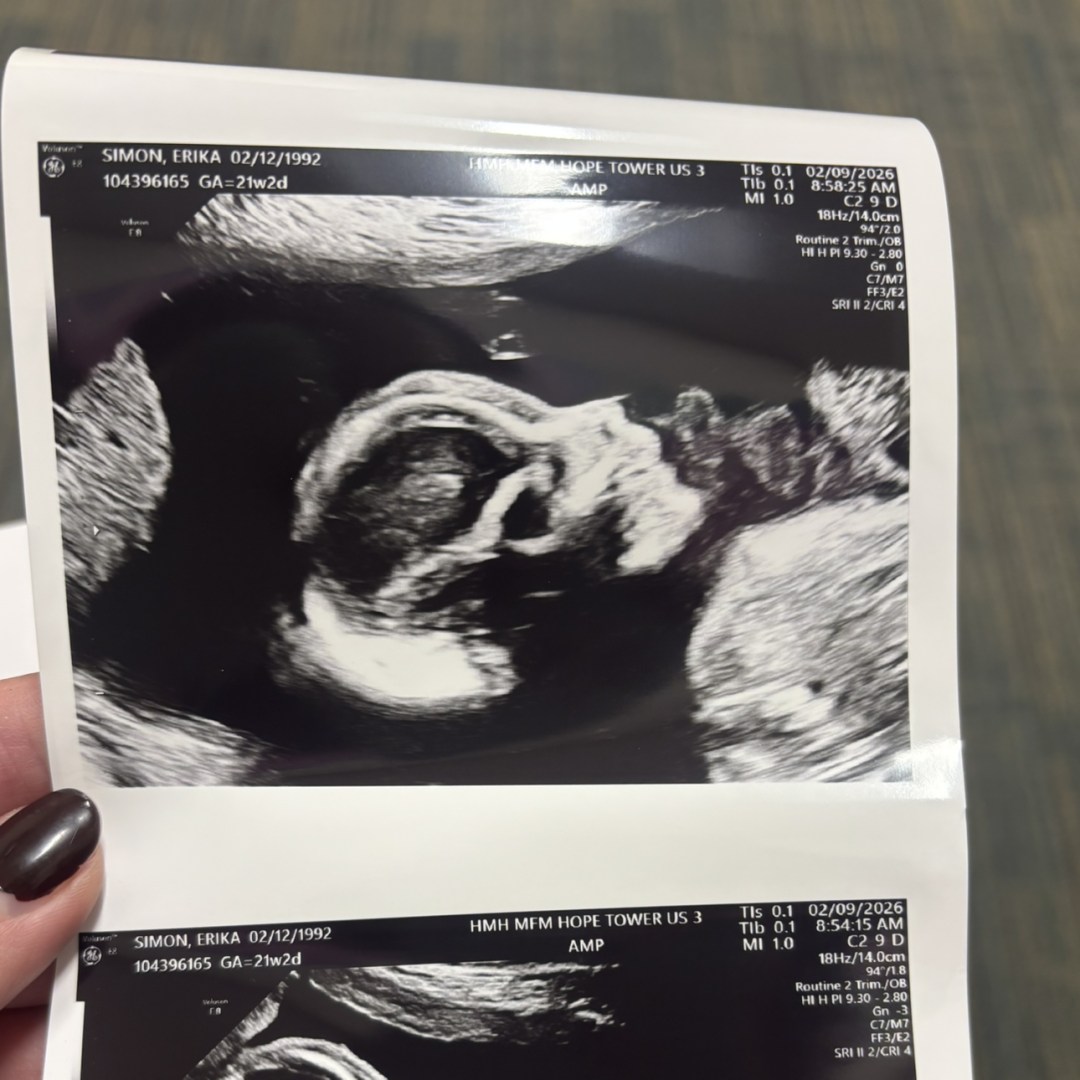 Photo shared by Erika for their Babylist baby registry.