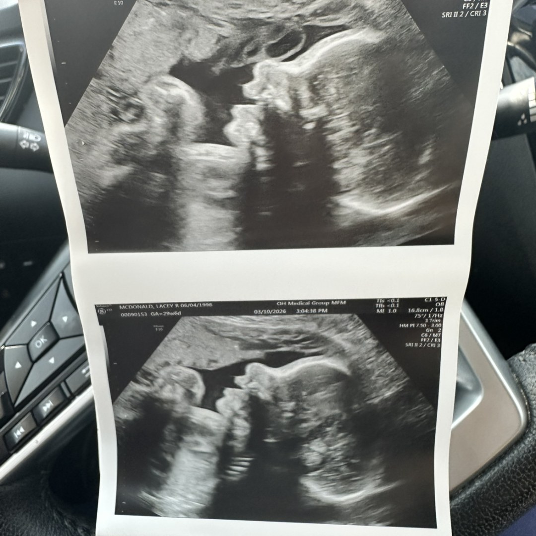 Photo shared by Lacey for their Babylist baby registry.