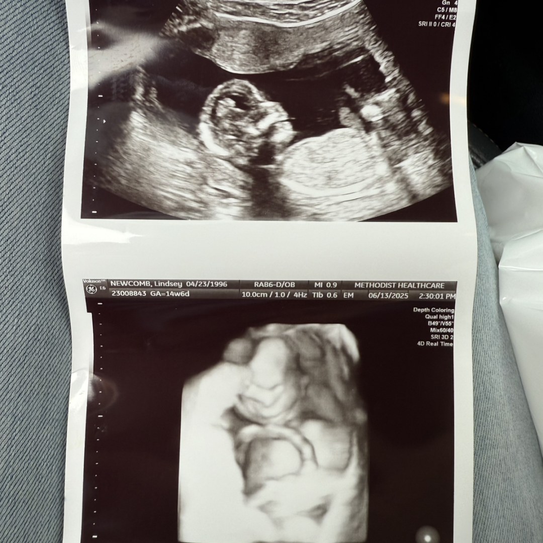 Photo shared by Lindsey for their Babylist baby registry.