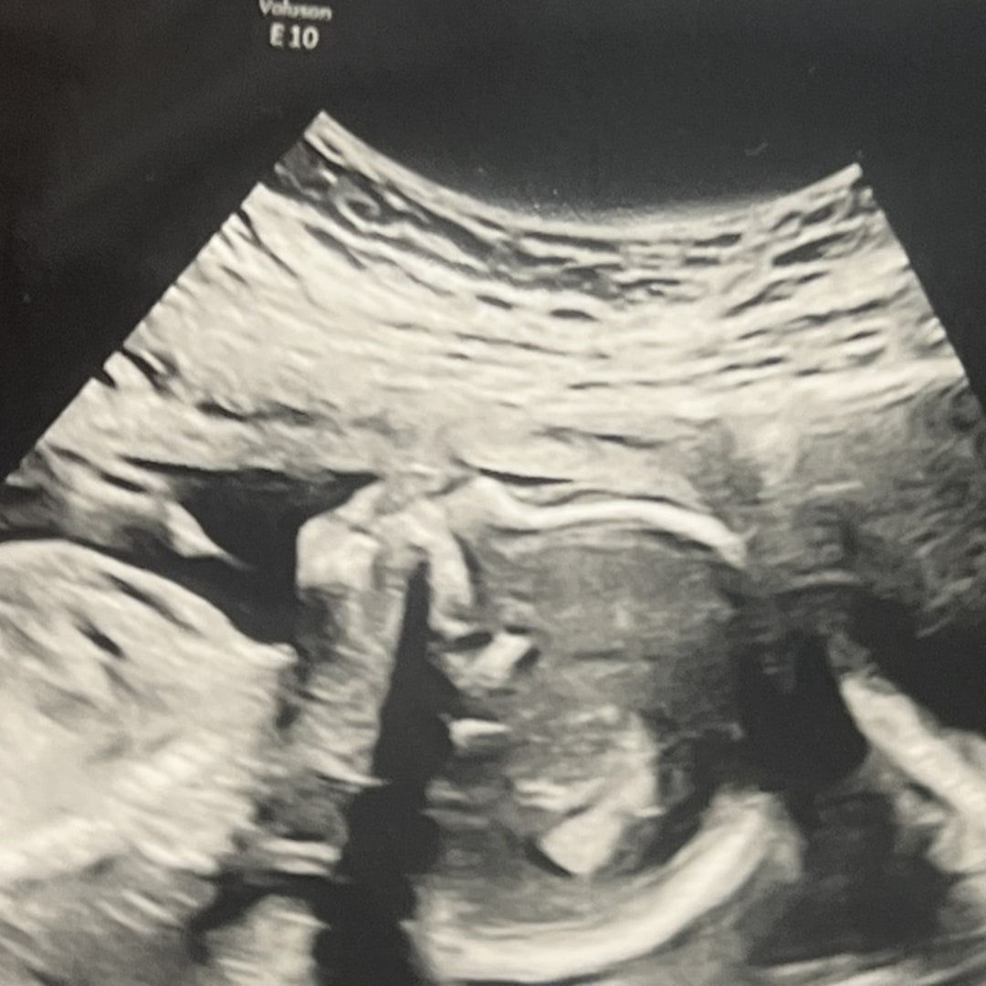 Photo shared by Alianna for their Babylist baby registry.