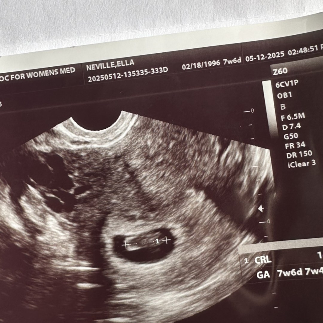 Photo shared by Ella and Zack for their Babylist baby registry.