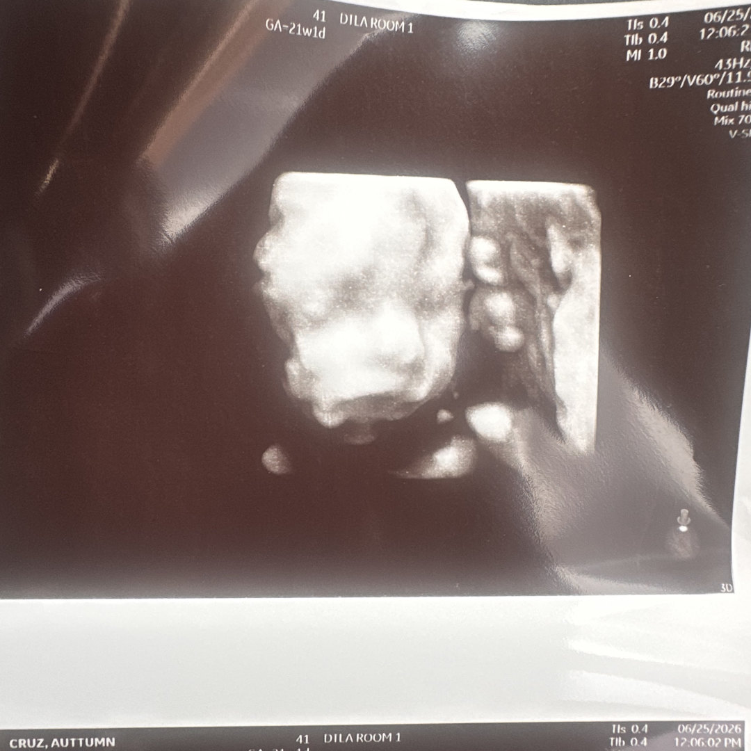 Photo shared by Autumn for their Babylist baby registry.