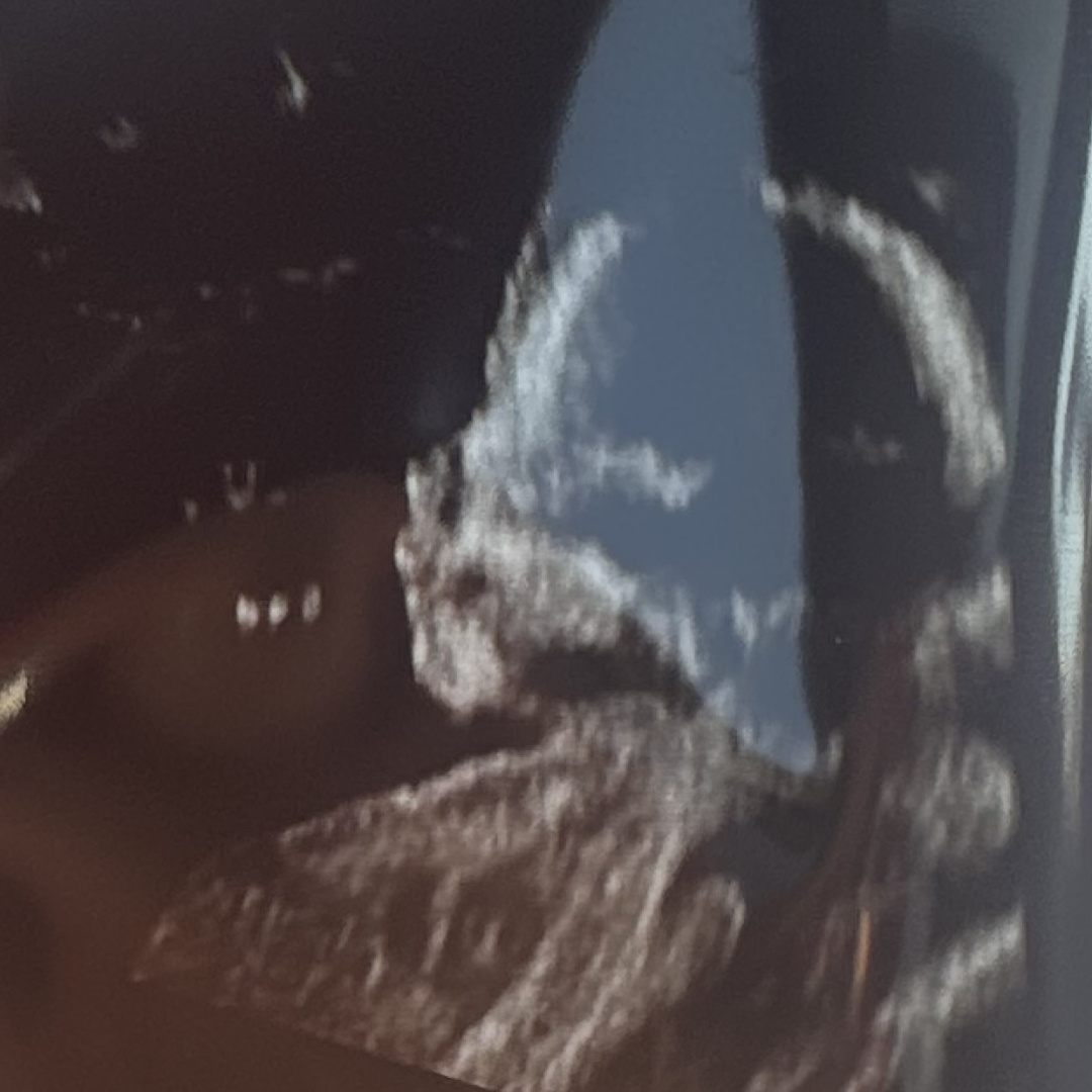Photo shared by Isabella for their Babylist baby registry.