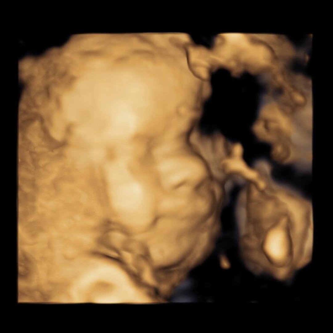 Photo shared by Tugba for their Babylist baby registry.