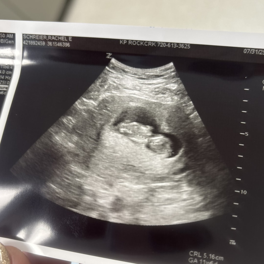 Photo shared by Rachel for their Babylist baby registry.