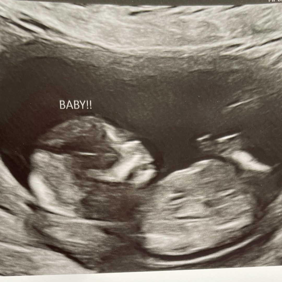 Photo shared by Vanessa for their Babylist baby registry.