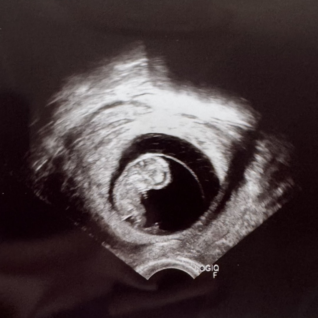 Photo shared by Danielle for their Babylist baby registry.