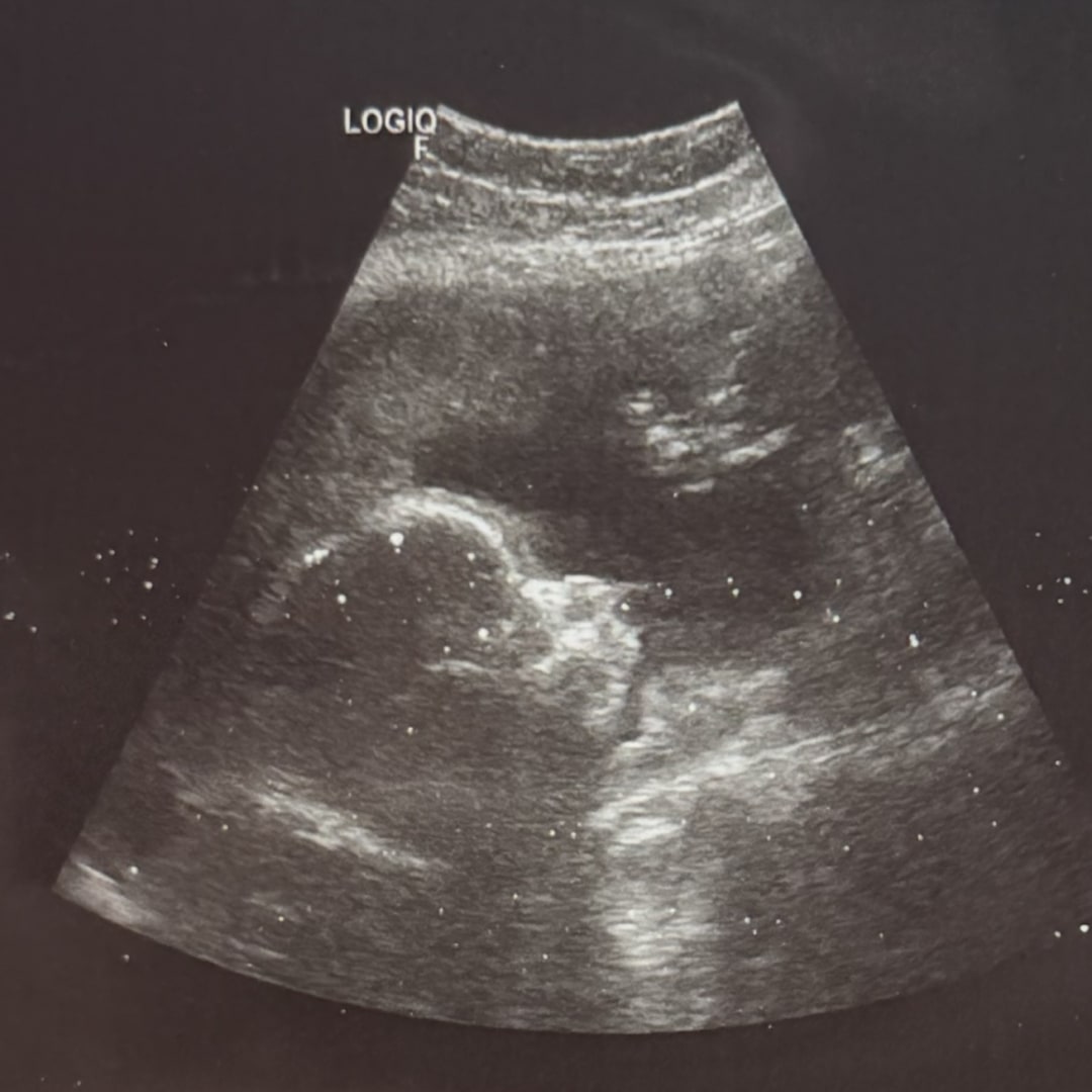 Photo shared by Allie for their Babylist baby registry.