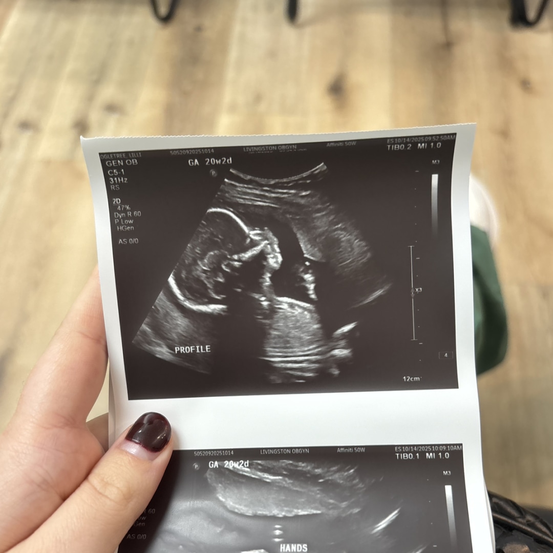 Photo shared by Lilli for their Babylist baby registry.