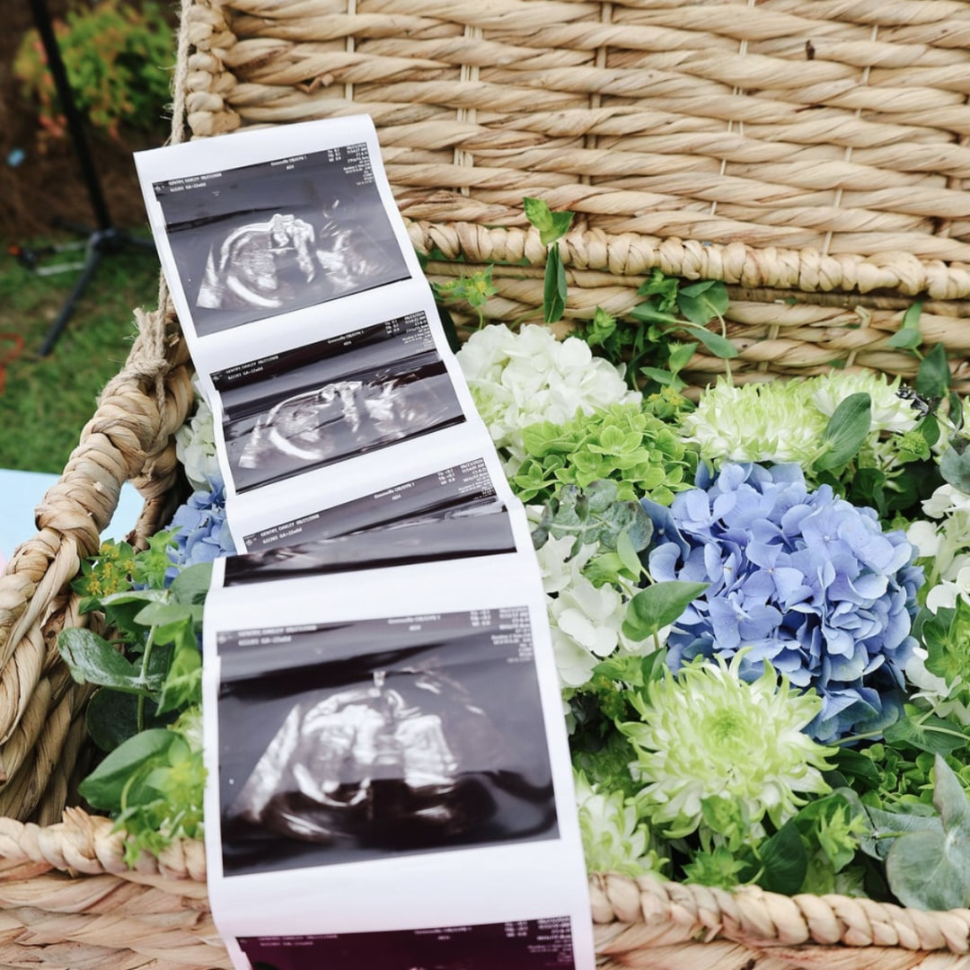 Photo shared by Gentry for their Babylist baby registry.