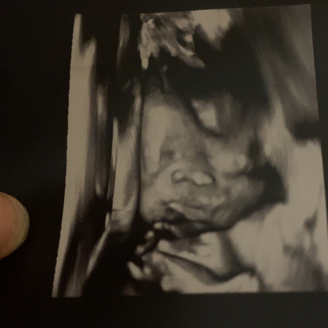 Photo shared by Ashaunti for their Babylist baby registry.