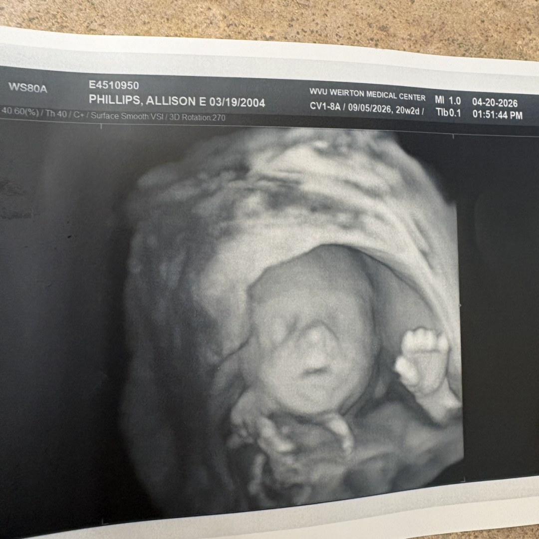 Photo shared by Allison for their Babylist baby registry.