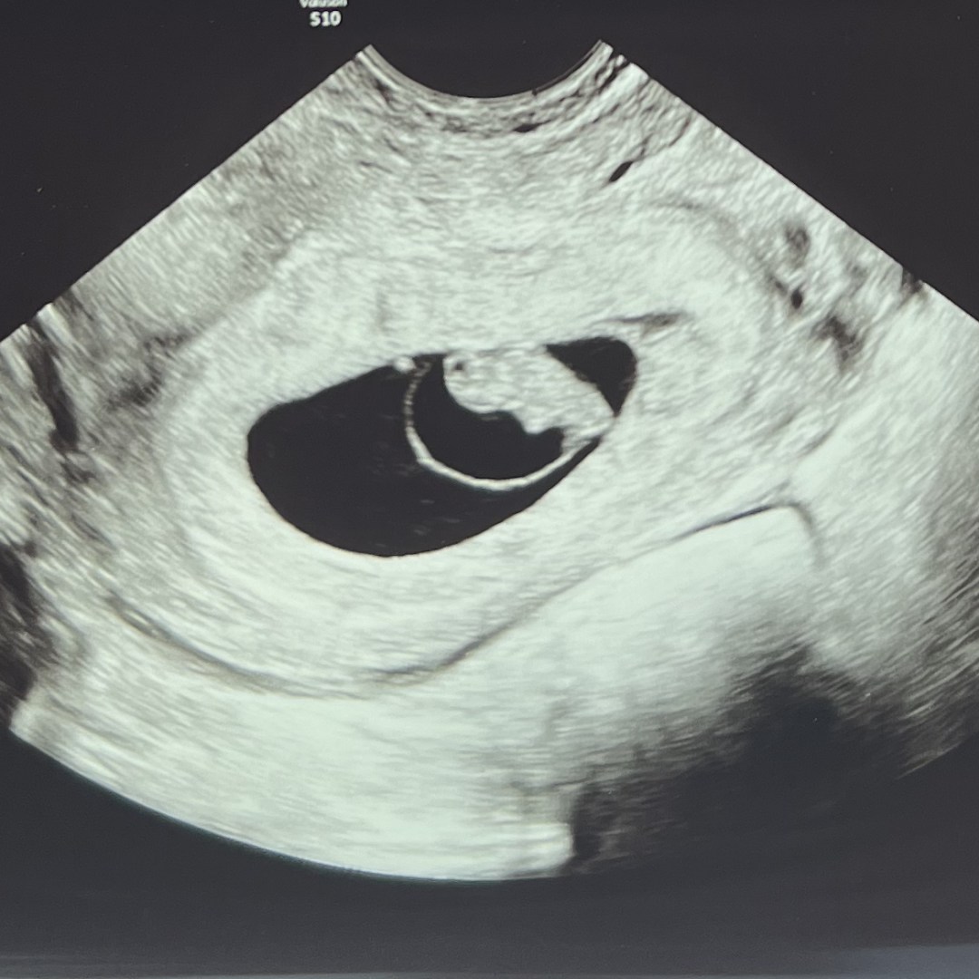 Photo shared by Athalie for their Babylist baby registry.