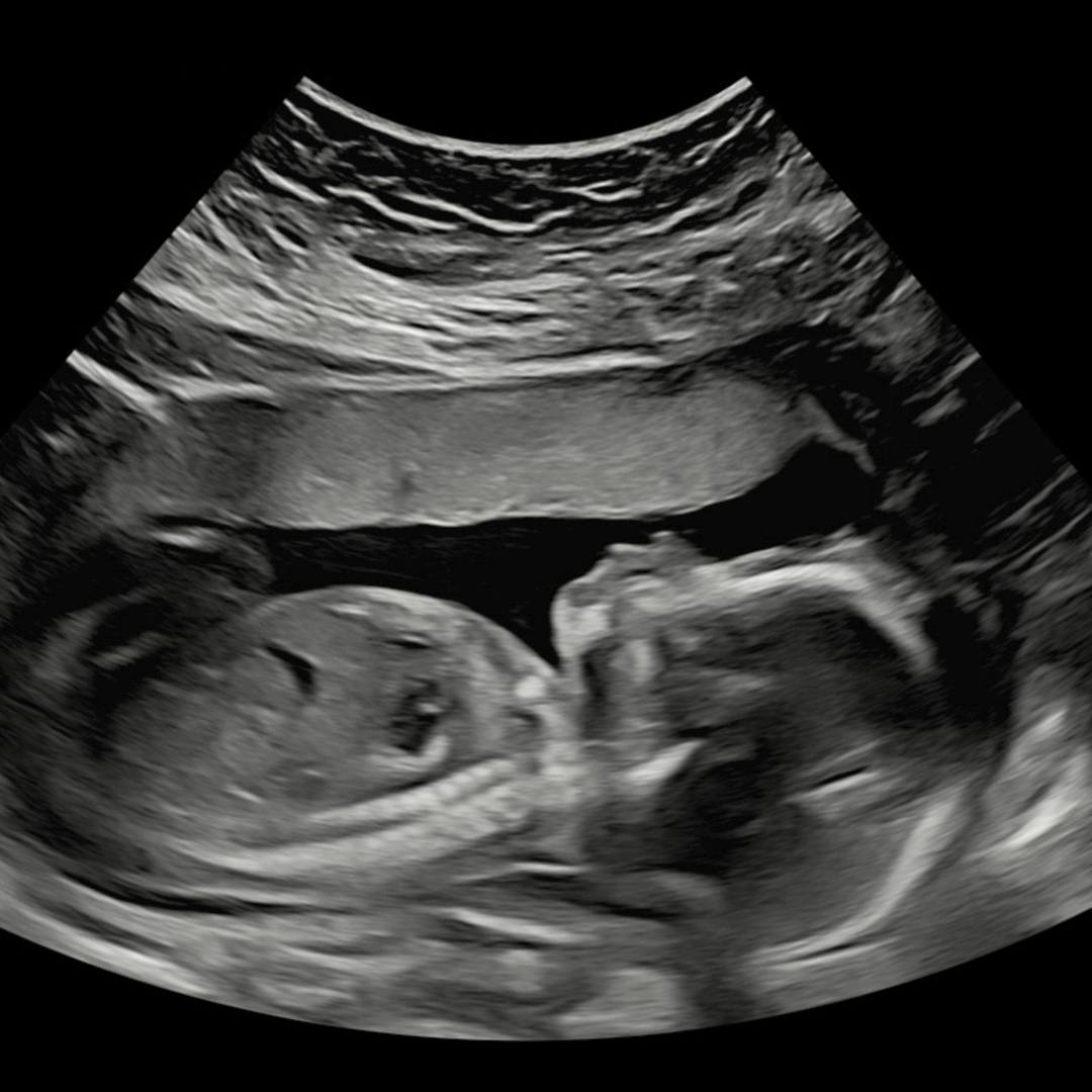 Photo shared by Lauren for their Babylist baby registry.