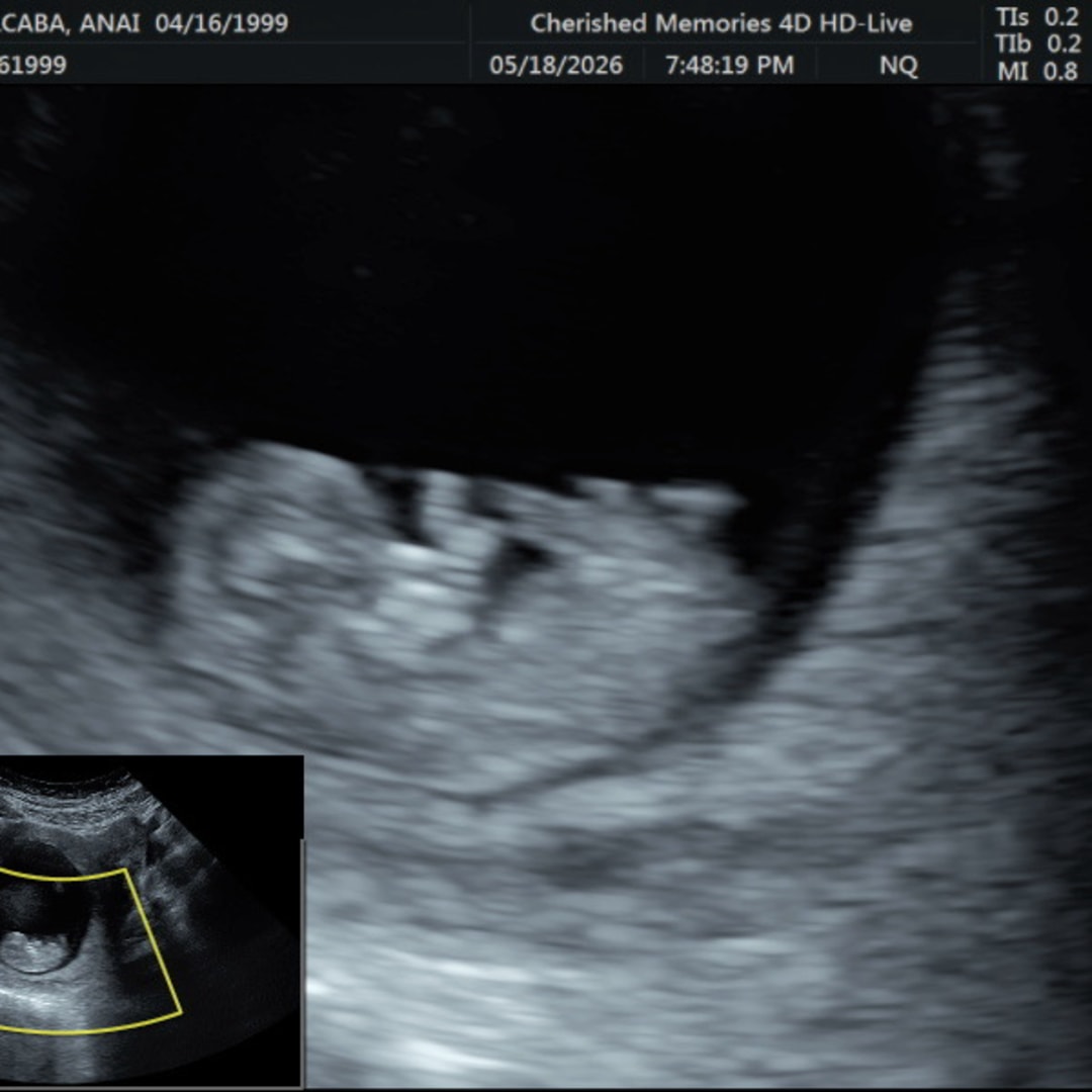 Photo shared by Anai for their Babylist baby registry.
