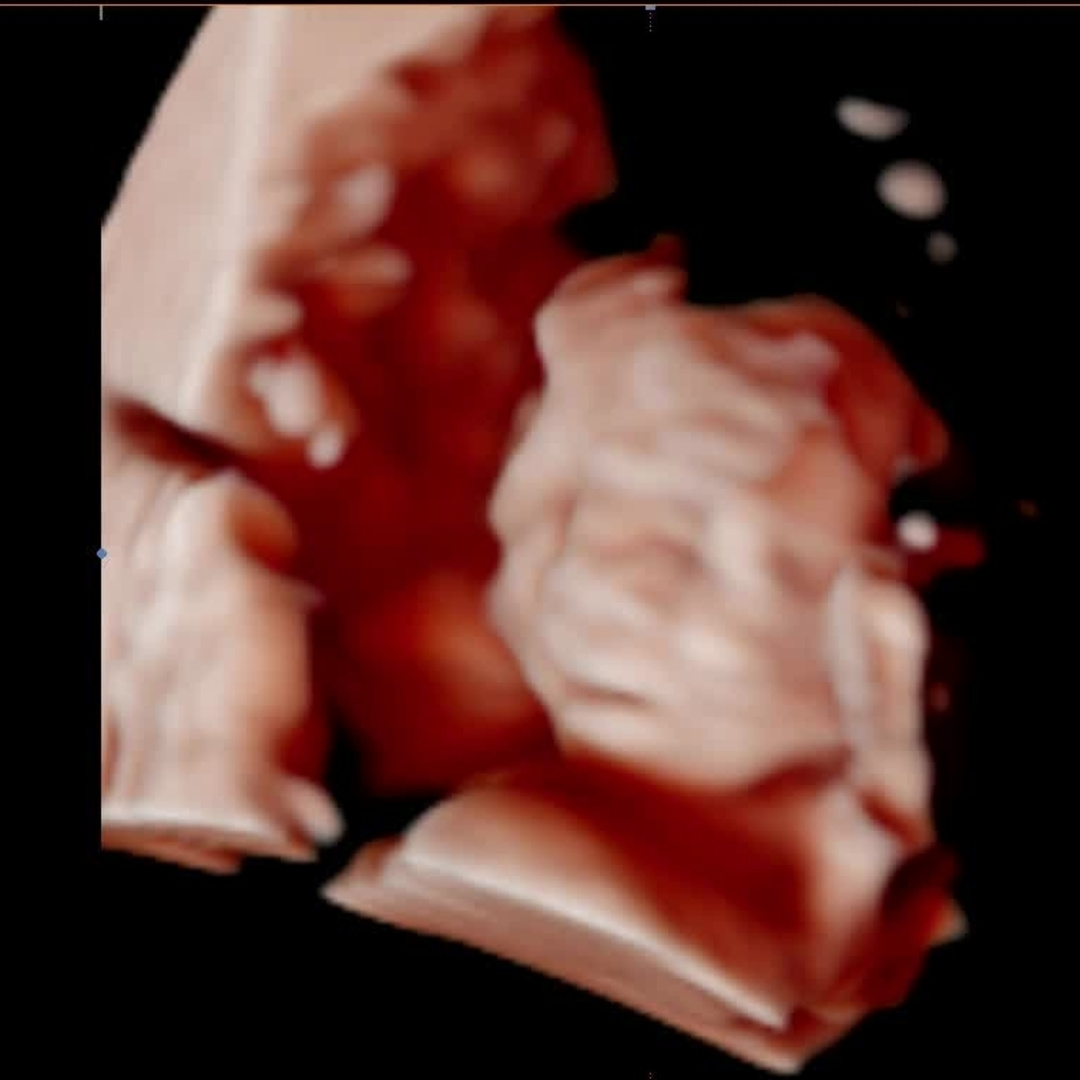 Photo shared by Hazel for their Babylist baby registry.