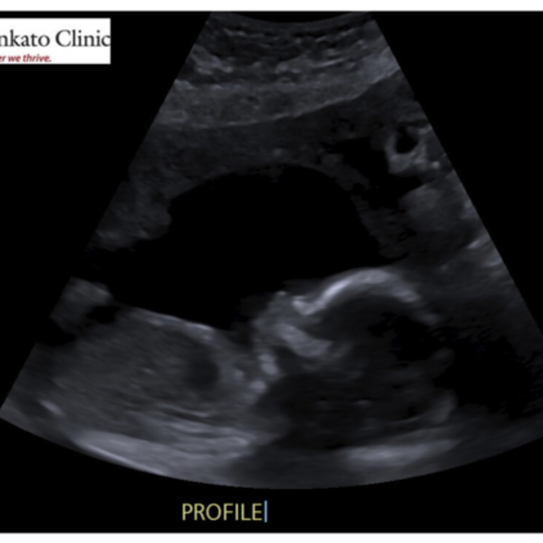 Photo shared by Joey for their Babylist baby registry.