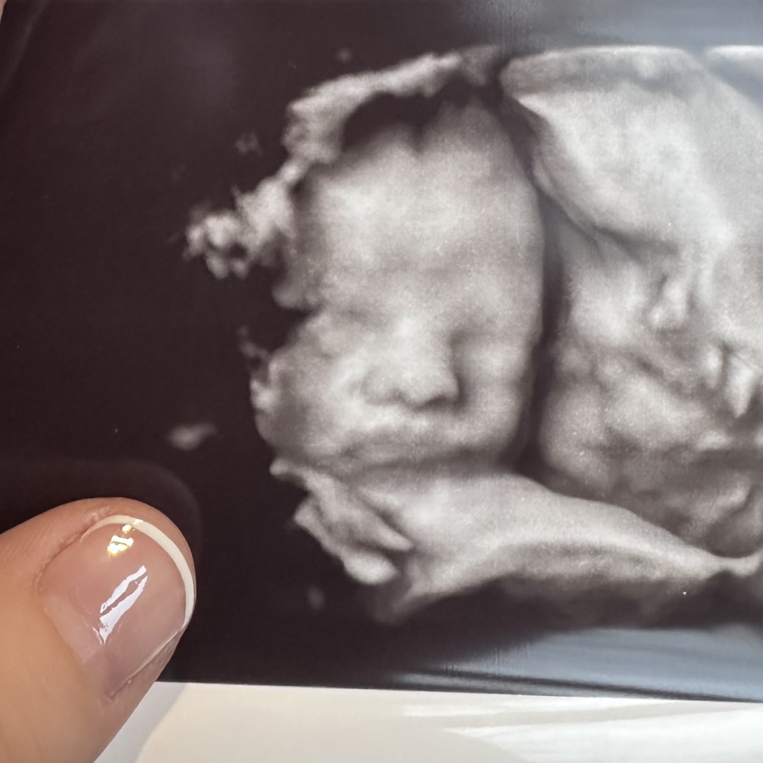 Photo shared by Jamie for their Babylist baby registry.