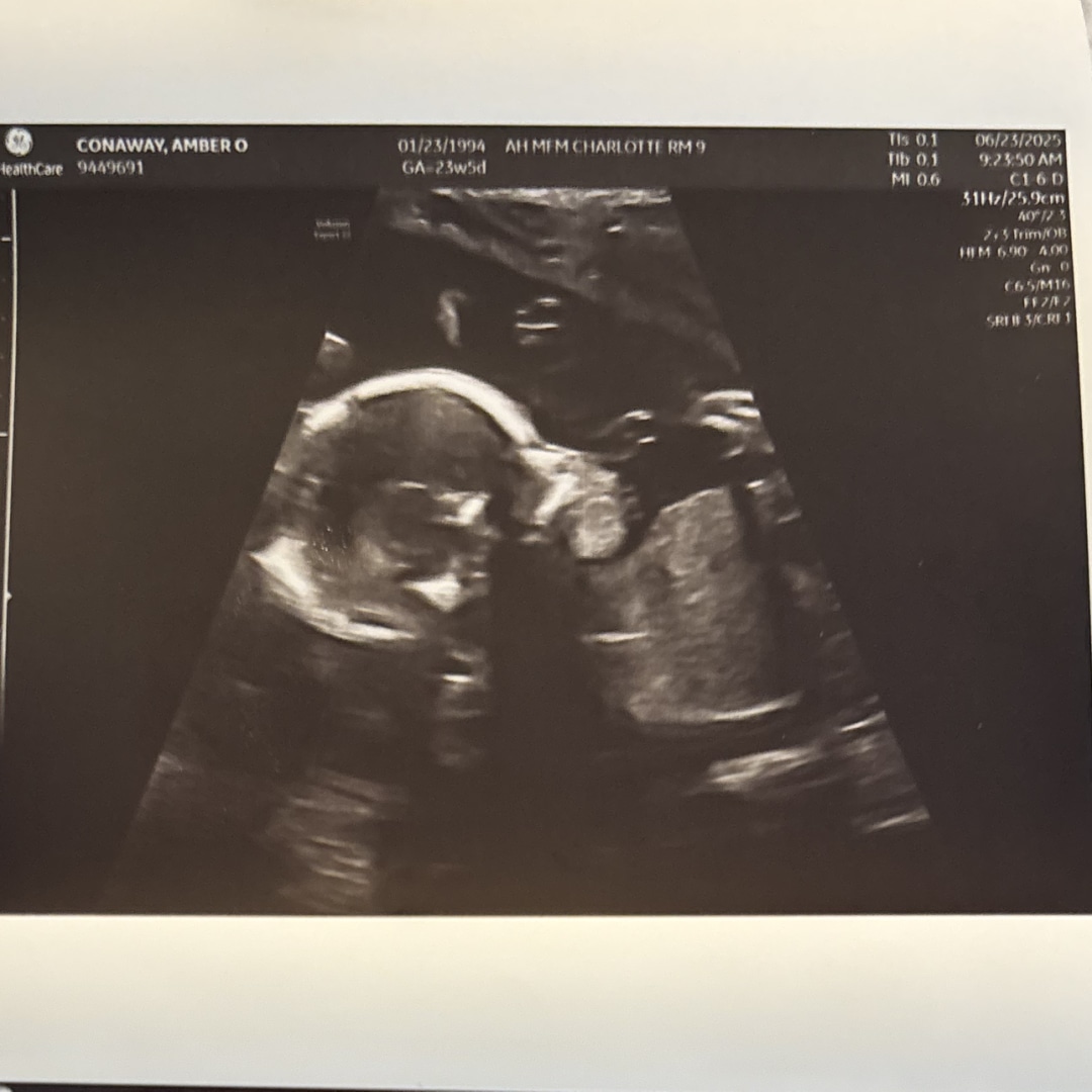 Photo shared by Amber for their Babylist baby registry.