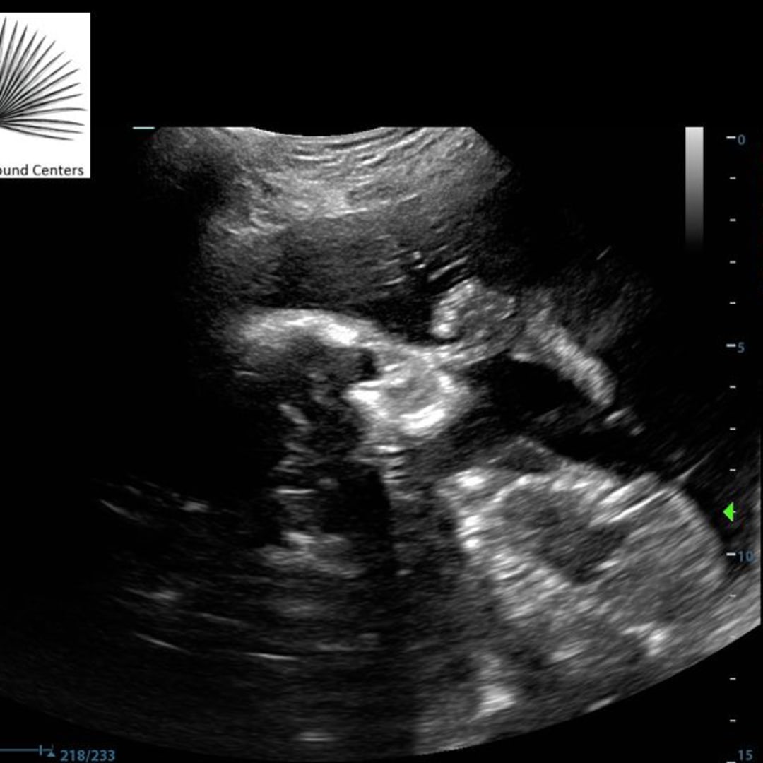 Photo shared by Elise for their Babylist baby registry.