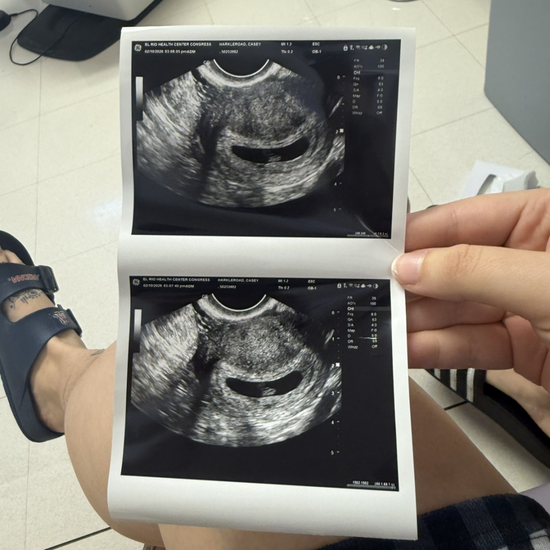 Photo shared by Casey for their Babylist baby registry.