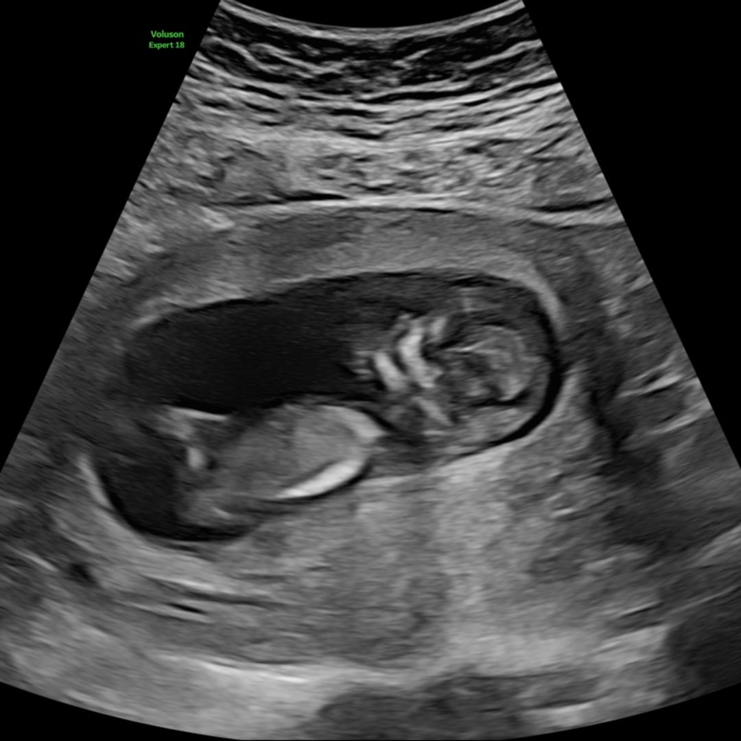Photo shared by Erica for their Babylist baby registry.