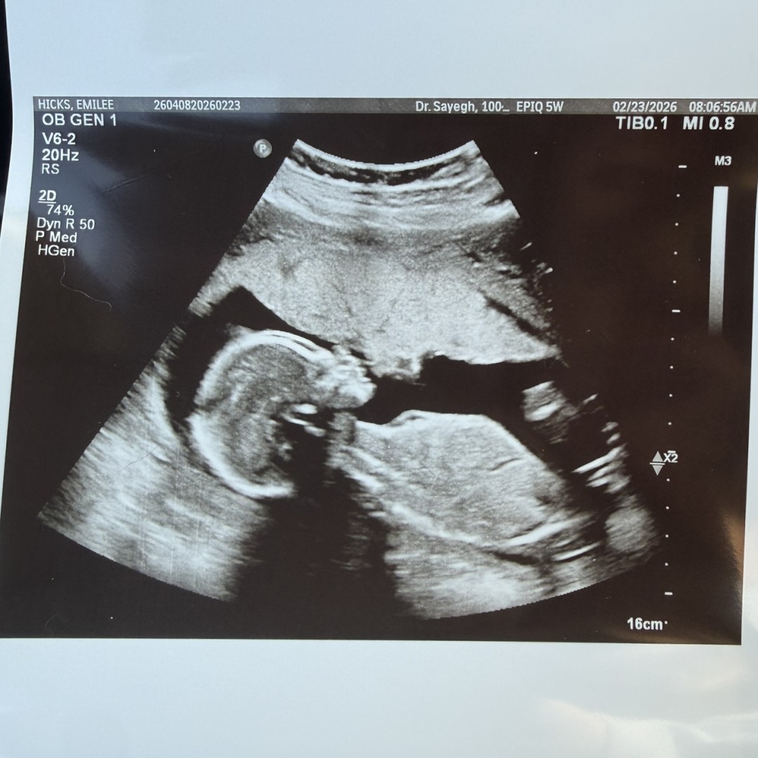 Photo shared by Emilee for their Babylist baby registry.