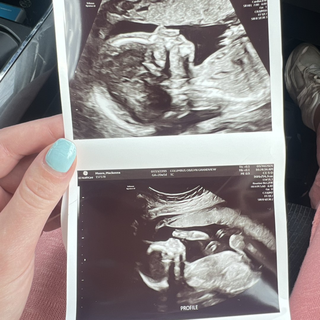 Photo shared by MacKenna for their Babylist baby registry.