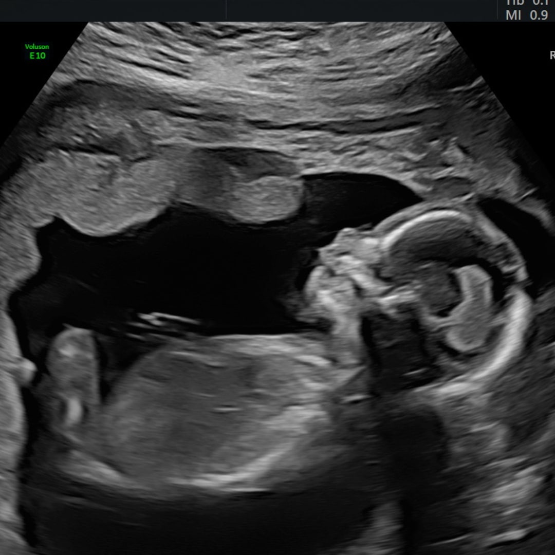 Photo shared by Jenna for their Babylist baby registry.