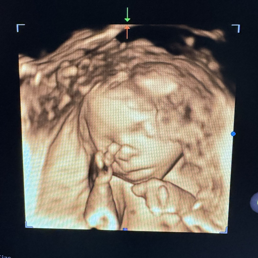 Photo shared by Samantha for their Babylist baby registry.