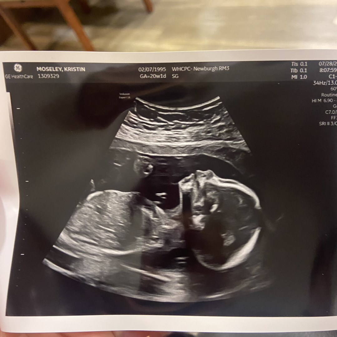 Photo shared by Kristin for their Babylist baby registry.