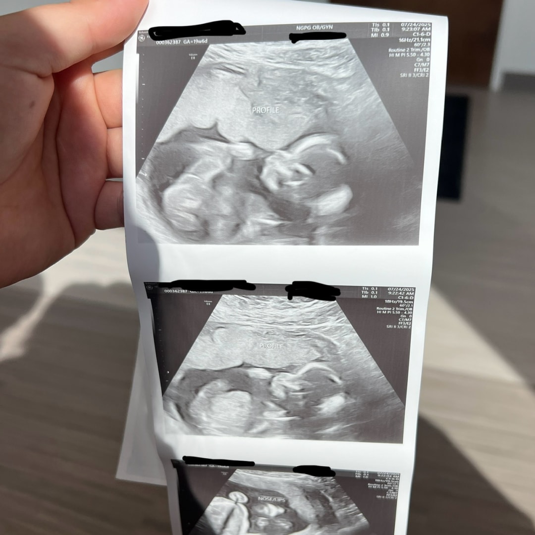 Photo shared by Ashley for their Babylist baby registry.