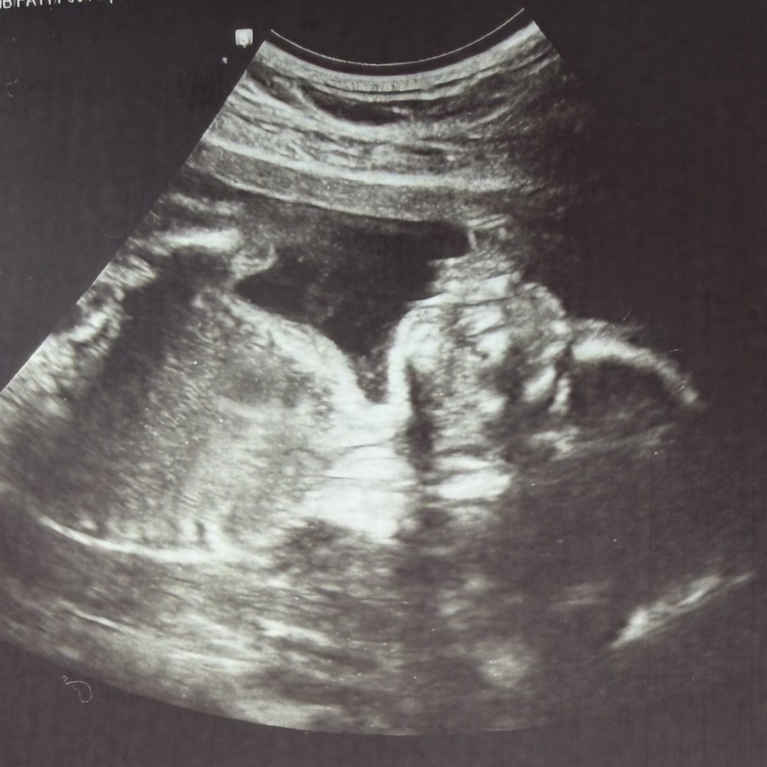 Photo shared by Abigail for their Babylist baby registry.