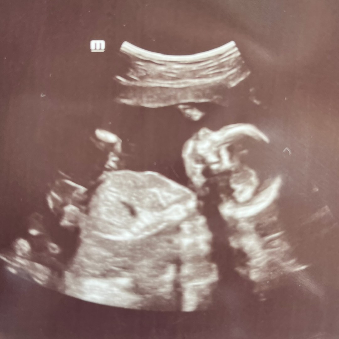 Photo shared by Julia for their Babylist baby registry.