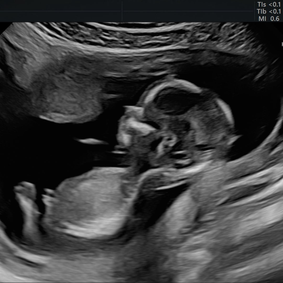 Photo shared by Autumn for their Babylist baby registry.