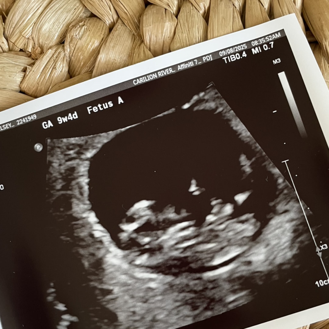 Photo shared by Chelsey for their Babylist baby registry.