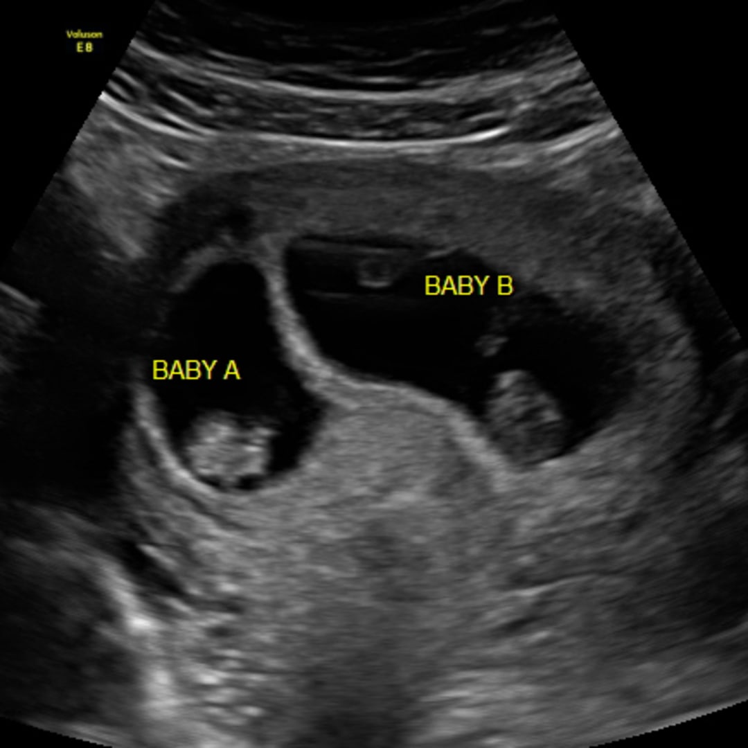 Photo shared by Cecelia for their Babylist baby registry.
