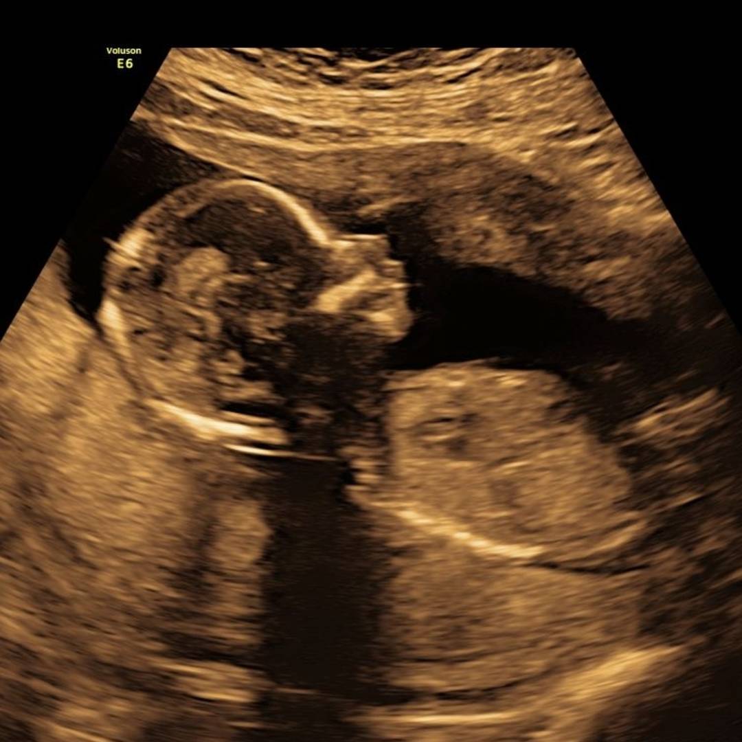 Photo shared by Mary for their Babylist baby registry.