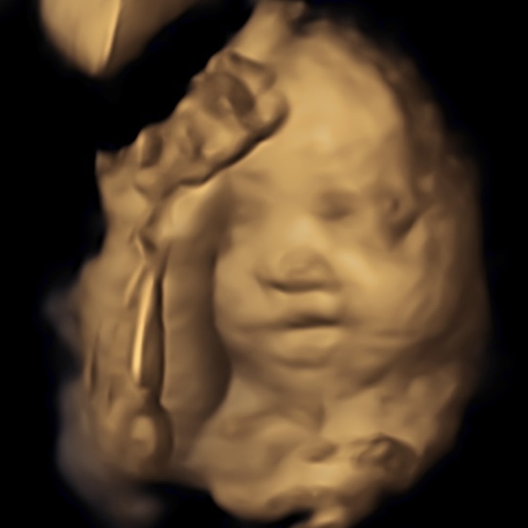 Photo shared by Bailey for their Babylist baby registry.