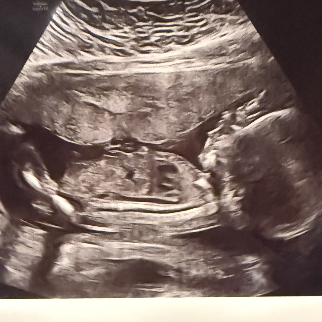Photo shared by Anna-Kate for their Babylist baby registry.