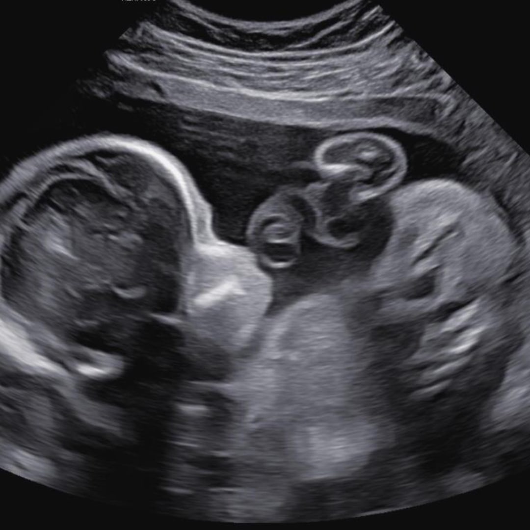 Photo shared by Theresa for their Babylist baby registry.